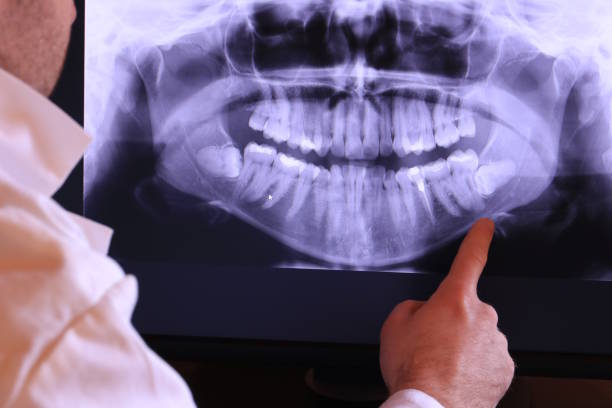Best Emergency Treatment for Oral Infections in Teaticket, MA