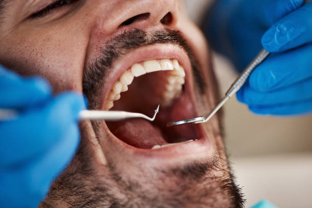 Best Emergency Cosmetic Dentistry (e.g., broken veneers) in Teaticket, MA