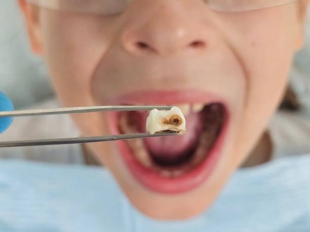 Best Emergency Care for Gum Disease in Teaticket, MA
